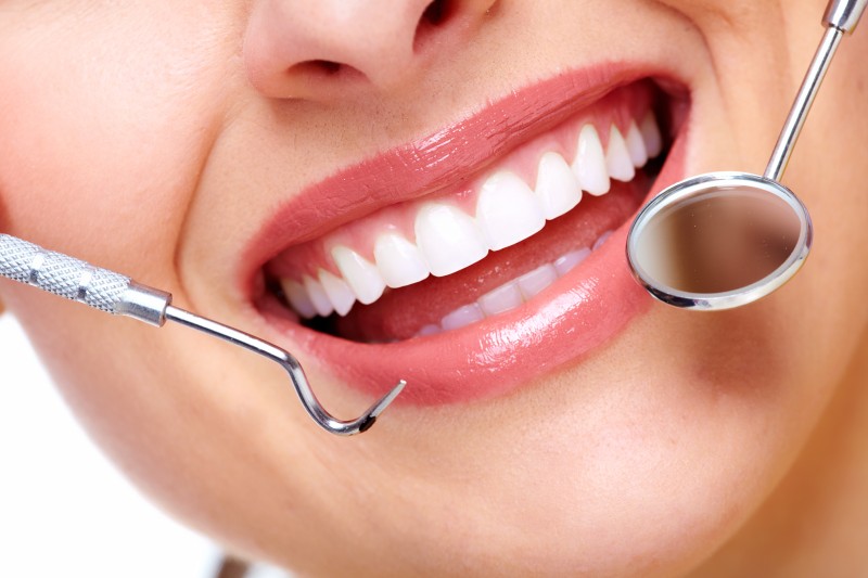 Things to Know If You’re Considering Professional Teeth Whitening in Gurnee